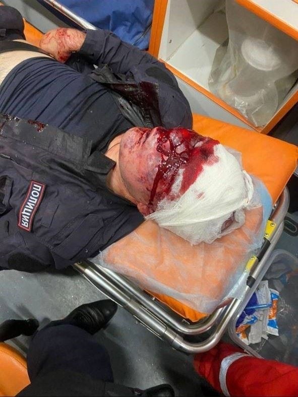 Нападение на сотрудников правоохранительных органов в Краснодаре: Кто напал, состояние пострадавших, фотографии нападавшего
