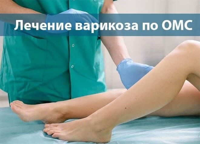 ЭВЛК - эндовенозная лазерная коагуляция