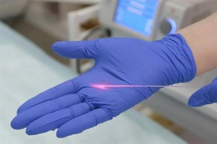 Федеральная программа по бесплатному лазерному удалению варикозных вен